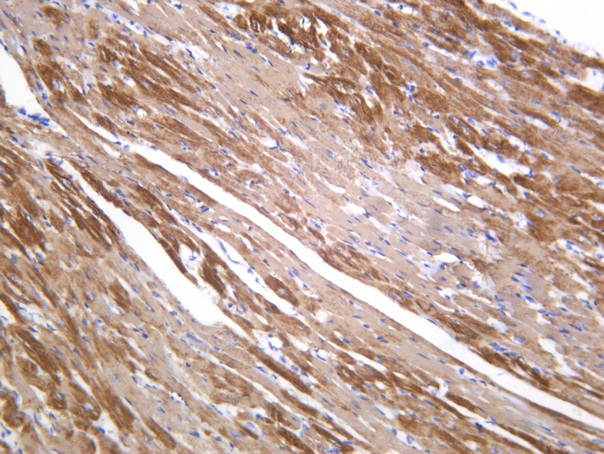 MYH7 Rabbit mAb