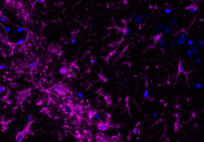 GFAP Rabbit mAb