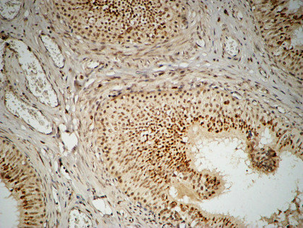FEN-1 Rabbit mAb