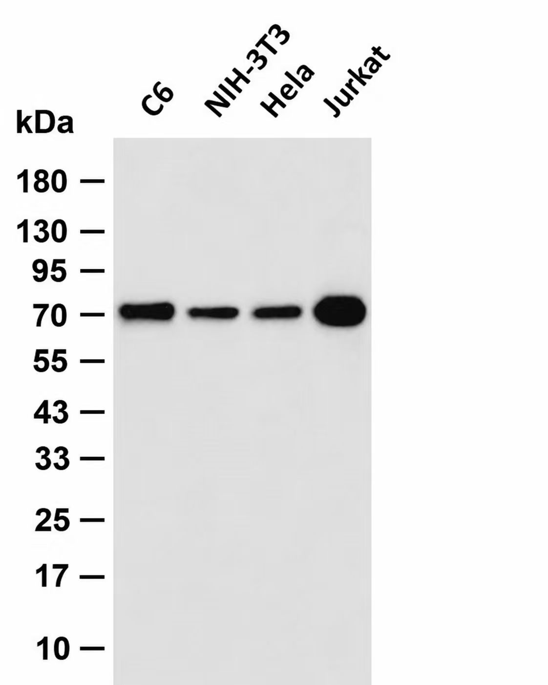 KAT7/Hbo1/MYST2  Rabbit mAb