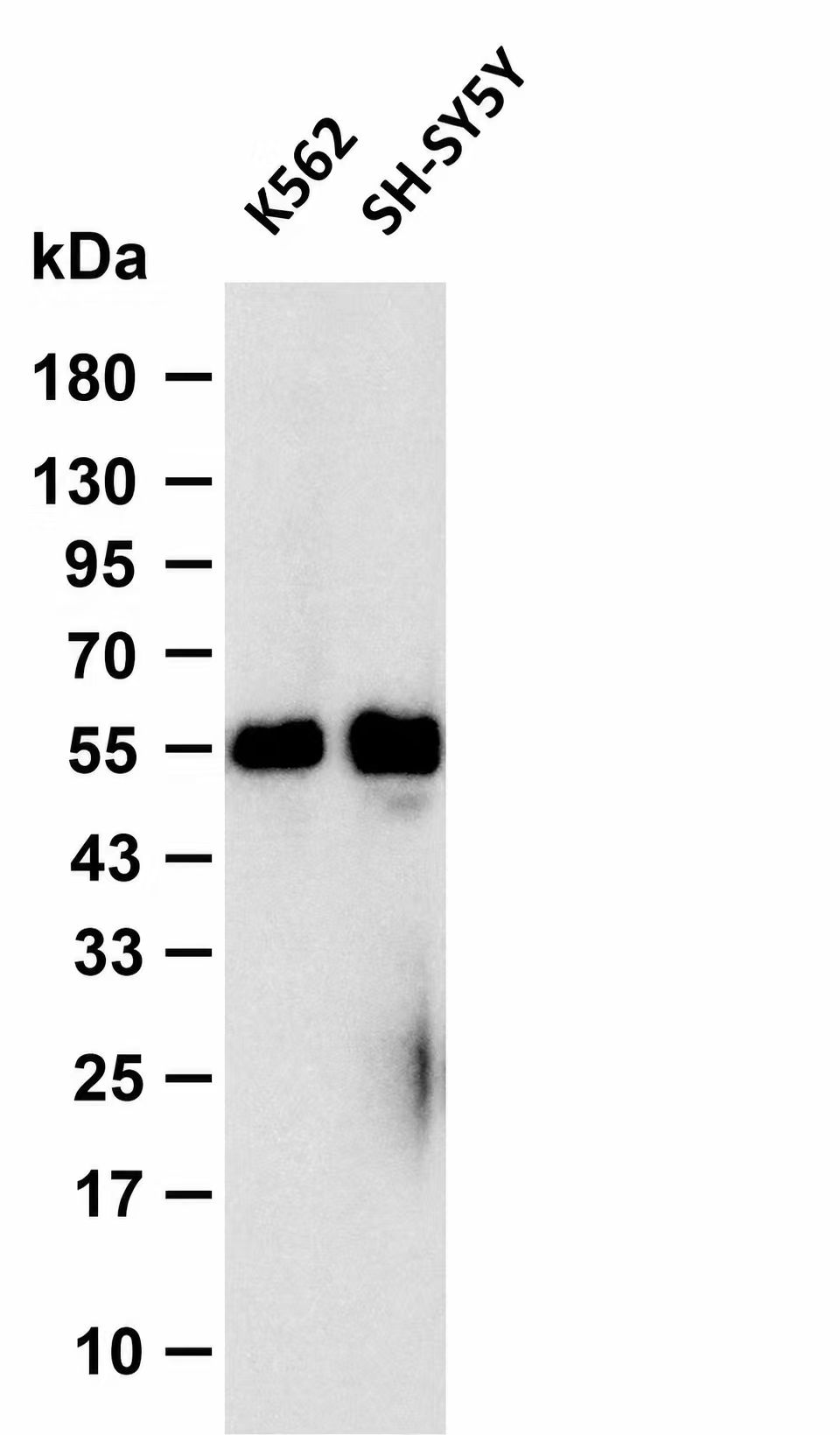 GATA 2  Rabbit mAb