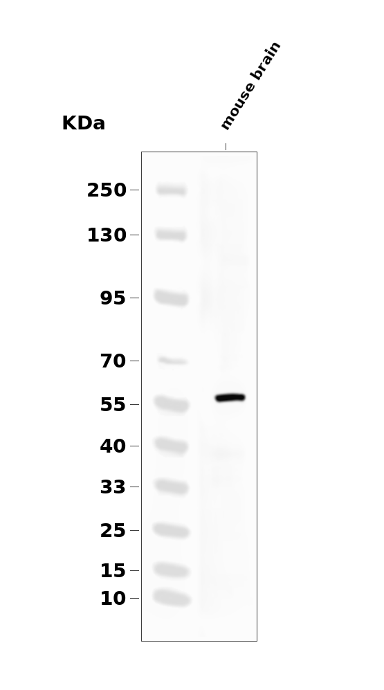 Tyrosine Hydroxylase (Phospho-Ser19) Antibody
