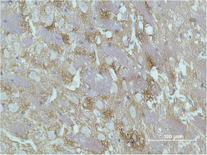GAP43 Mouse mAb