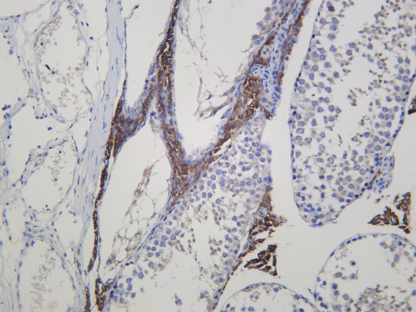 Cytochrome P450 11A1 Antibody