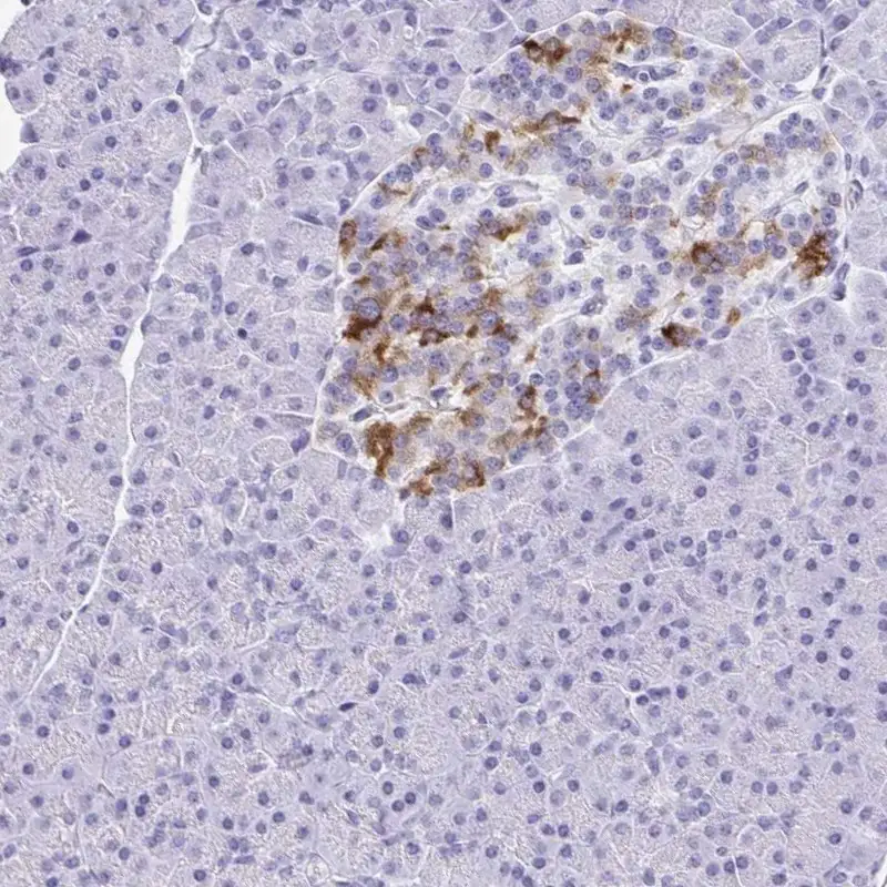IAPP (YD19869) Rabbit mAb