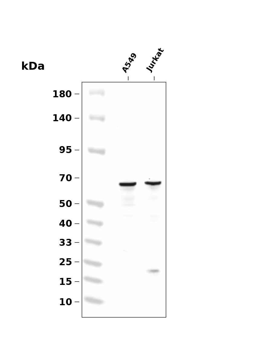 SLC1A5 (YD19941) Rabbit mAb