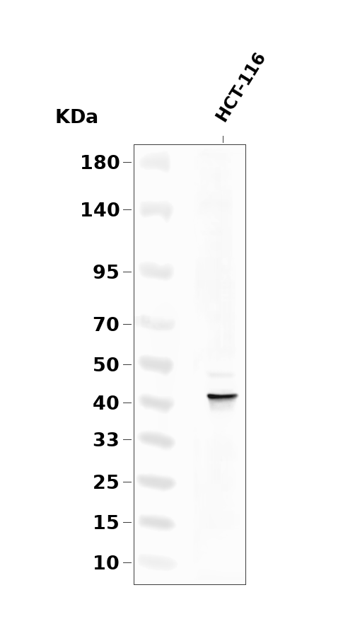 Aurora A (Phospho-Thr288) Antibody