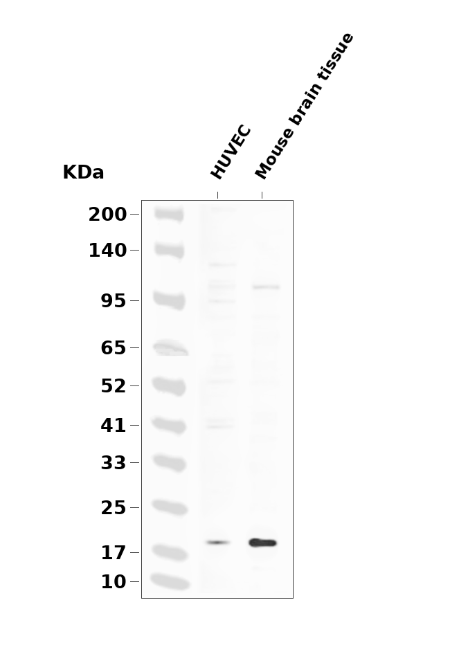 Claudin 5 (Phospho-Tyr217) Antibody