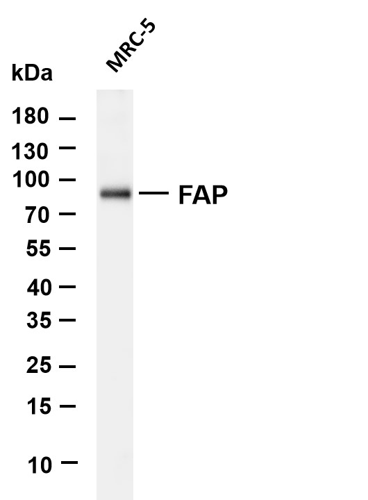 FAP Rabbit mAb