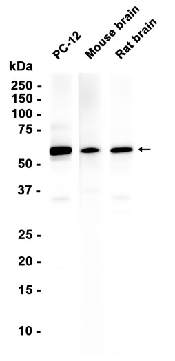Tyrosine 3-monooxygenase (YD12354) Rabbit mAb
