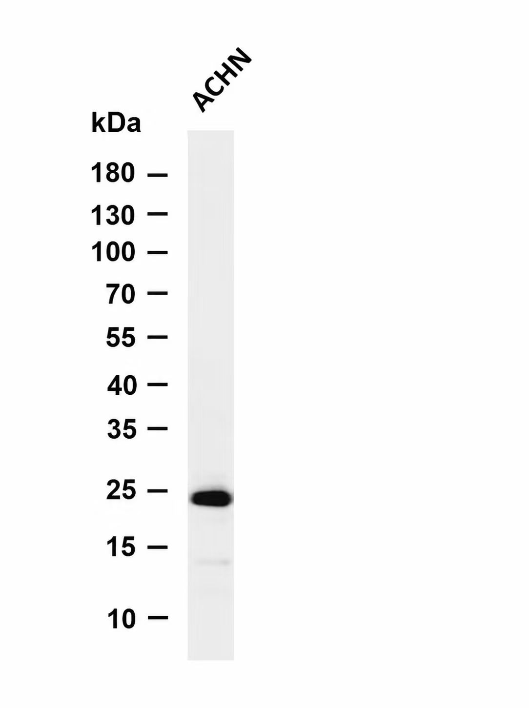Claudin 7 (Phospho-Tyr210) Antibody