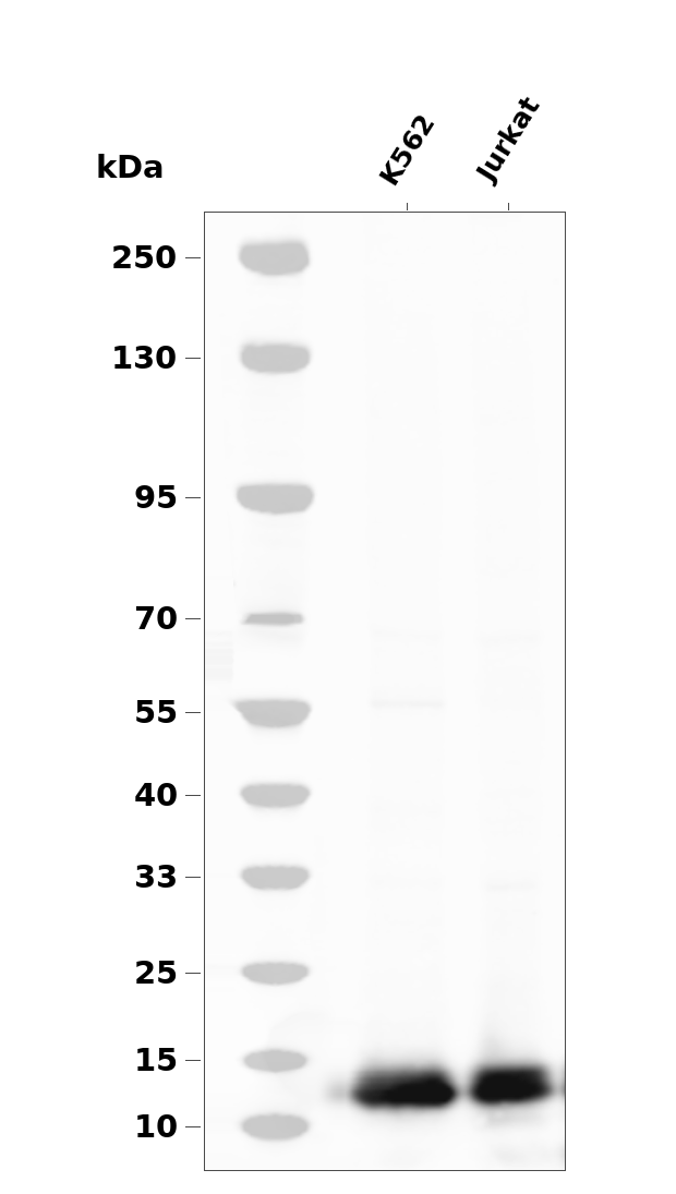4E-BP1 (Phospho-Thr69) Antibody