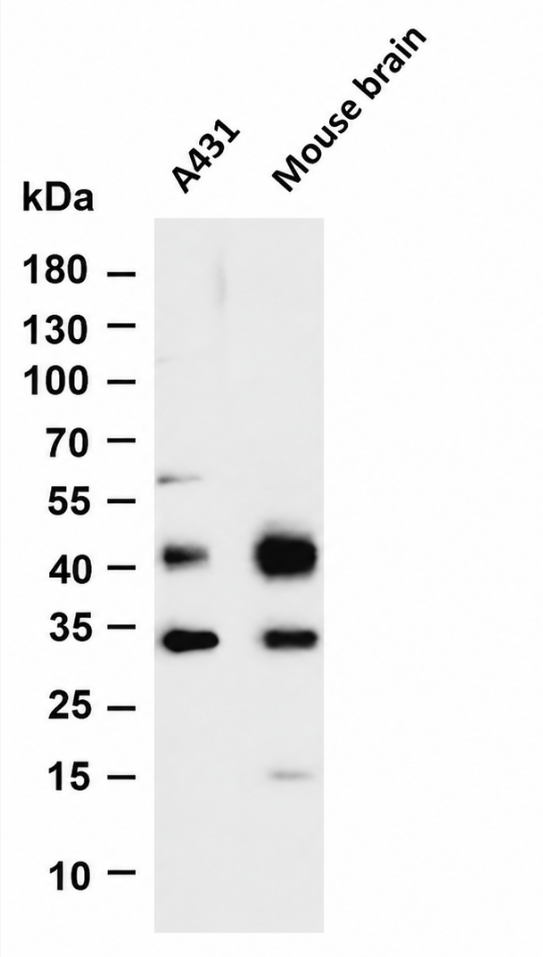 Cathepsin D Rabbit mAb