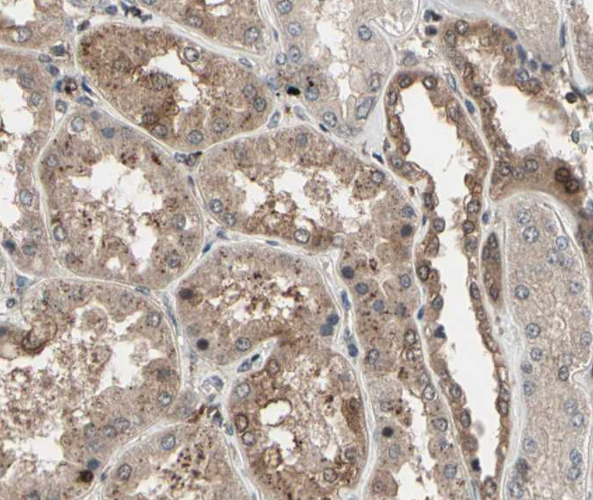 CSF1R (YD35054) Rat mAb