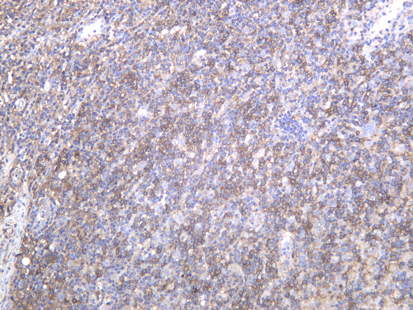 CCR7 Rabbit mAb