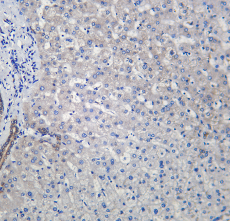 DAP 1 Rabbit mAb