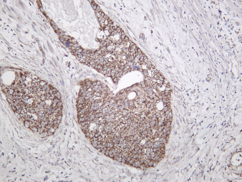 TOMM20 Rabbit mAb