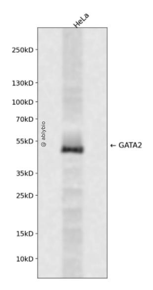 GATA2 (Phospho-Ser401) Antibody