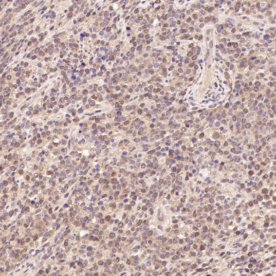 SIRT1 Rabbit mAb