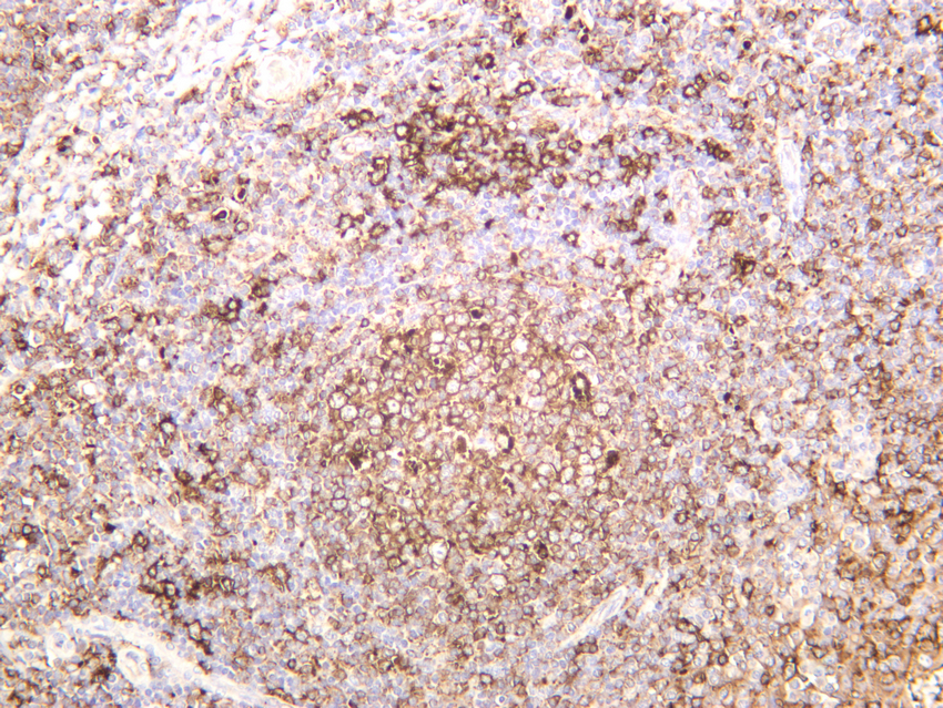 HLA-DR Rabbit mAb