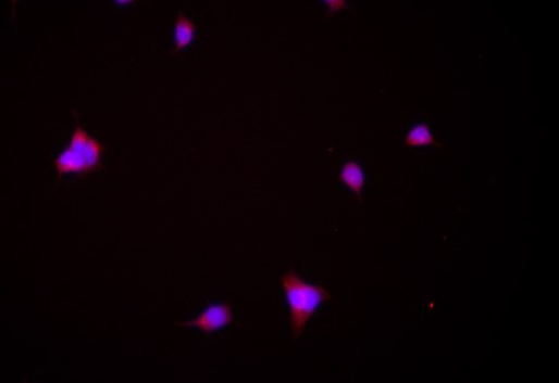 Aurora A Rabbit mAb