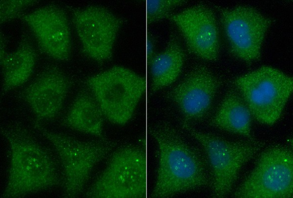 G-CSF (YD14179) Rabbit mAb