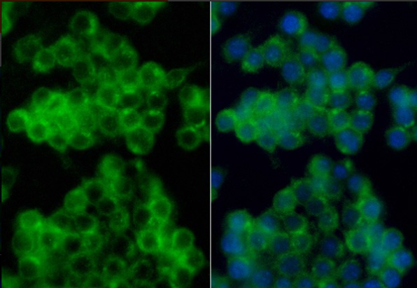 CSF1R (YD34250) Rabbit mAb
