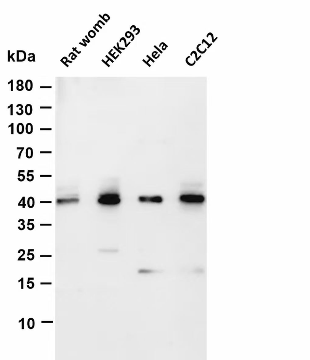 Connexin 43/GJA1 Rabbit mAb