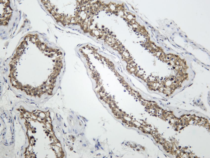 Huntingtin Rabbit mAb