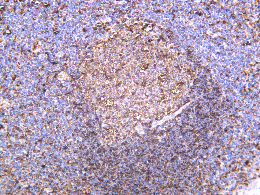 MHC Class II beta Rabbit mAb