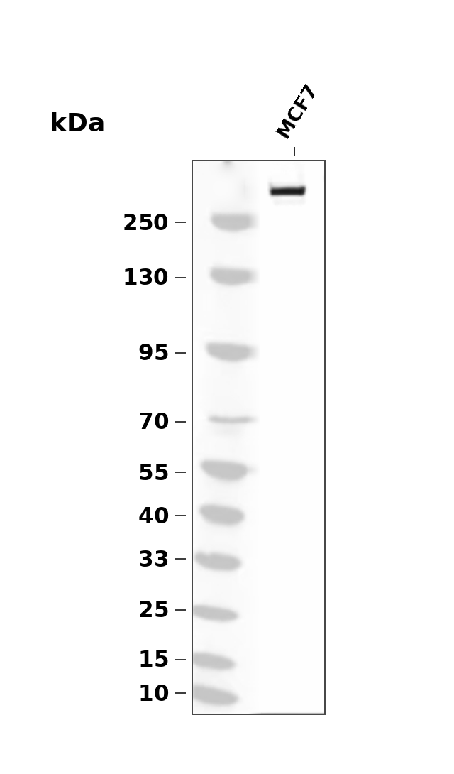 Laminin alpha 5 (YD14553) Rabbit mAb