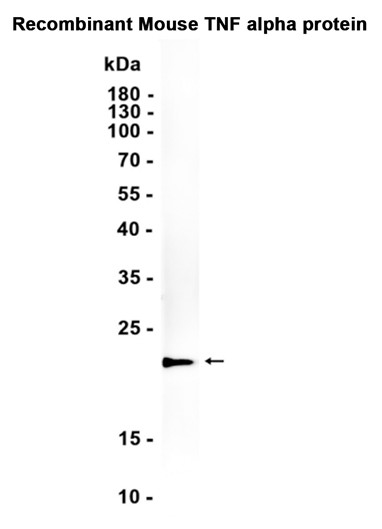TNF alpha (YD14570) Rabbit mAb