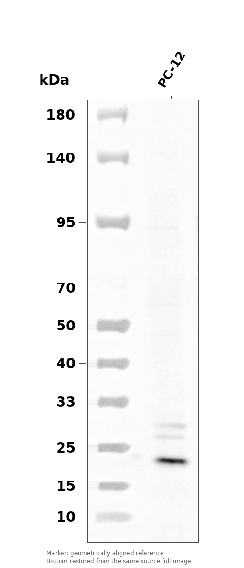 BAD (Phospho-Ser91/128) Antibody