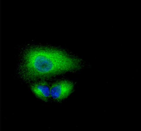 Phospho-beta Catenin (Ser37) pAb