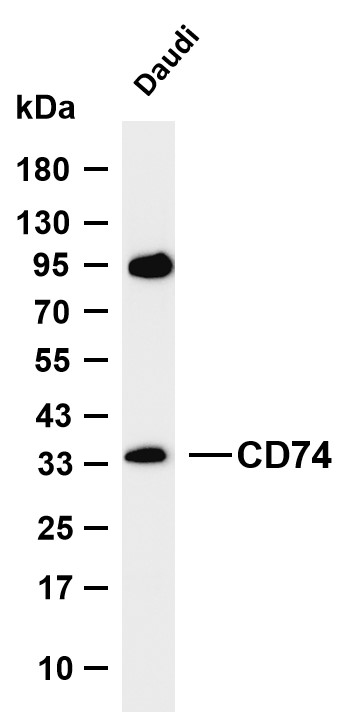 CD74 Rabbit mAb