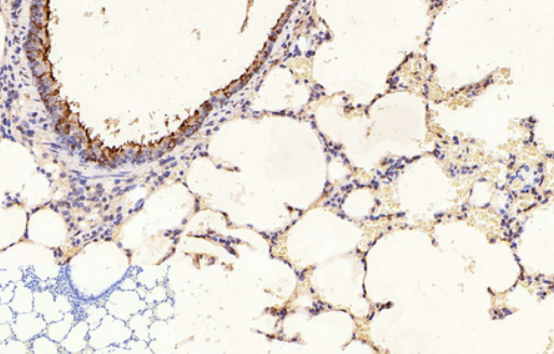 &beta; III Tubulin Mouse mAb