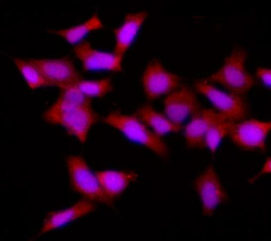 Smad1  Rabbit mAb