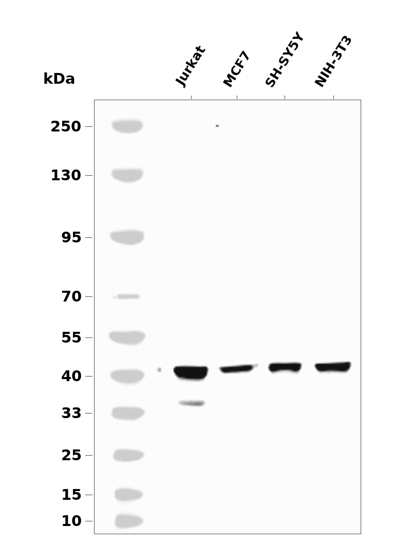 alpha smooth muscle Actin Rabbit mAb