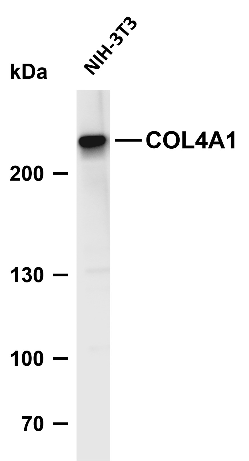 Collagen IV Rabbit mAb