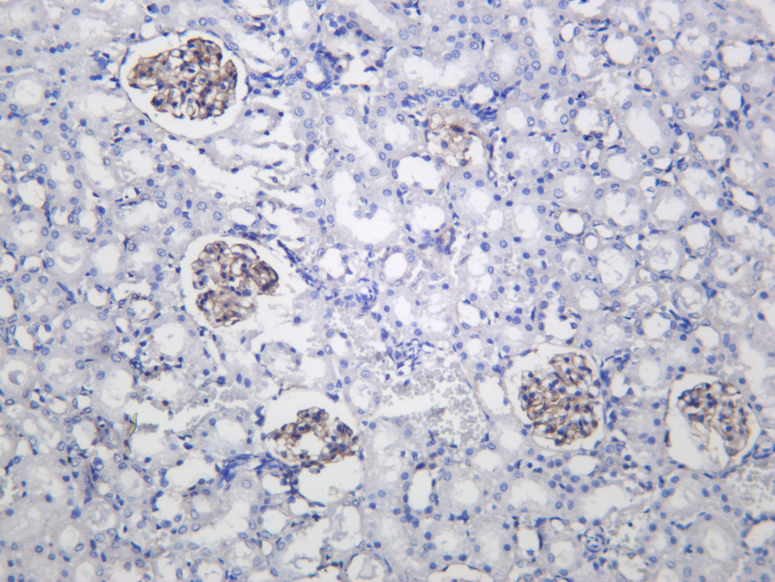 Integrin &beta;5 Rabbit mAb