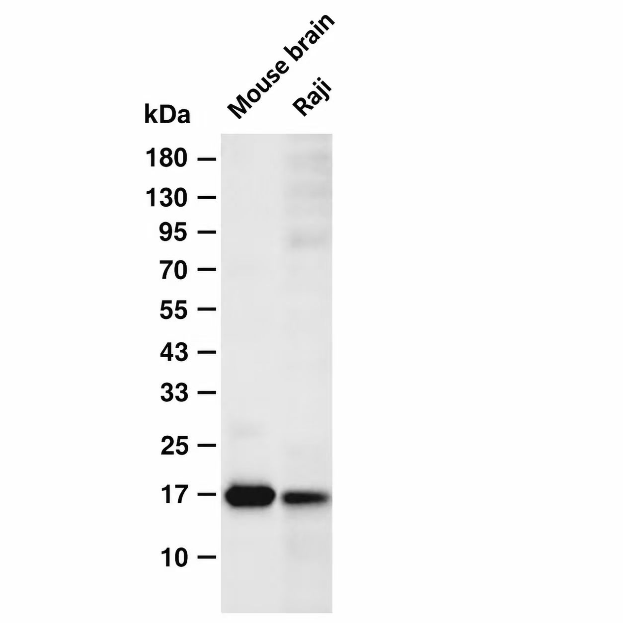 GABARAP (YD13715) Rabbit mAb