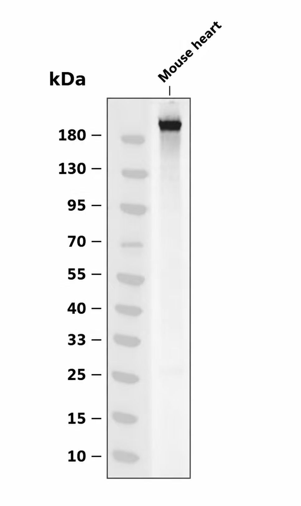 Phospho-MLC2 (Ser19) pAb