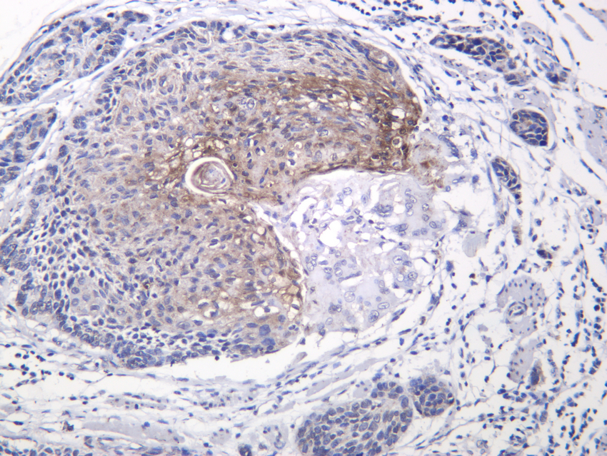 G-CSF Rabbit mAb
