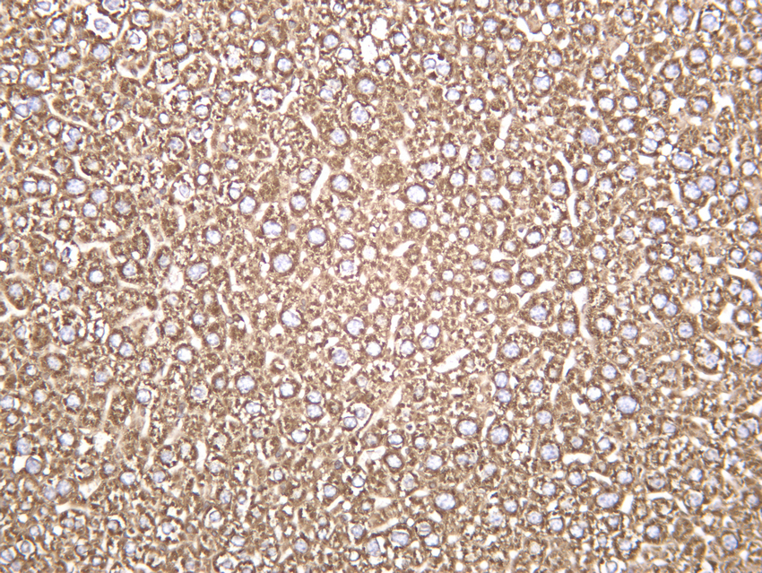 Calreticulin Rabbit mAb