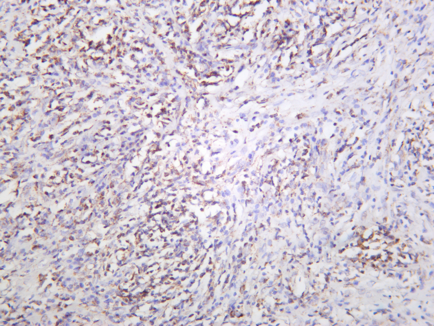 mtTFA Rabbit mAb