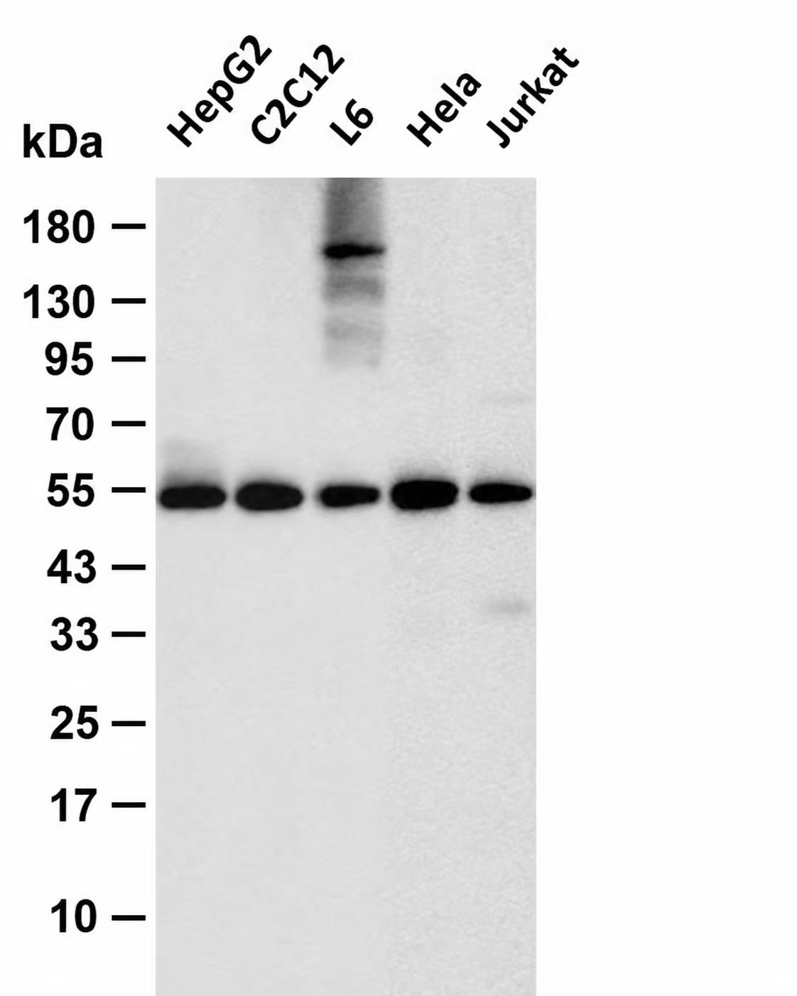 DAPK3 Rabbit mAb