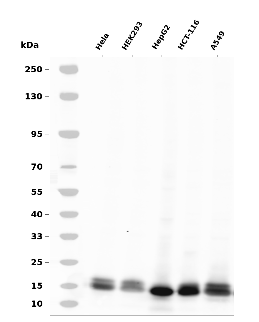 4E-BP1 Rabbit mAb