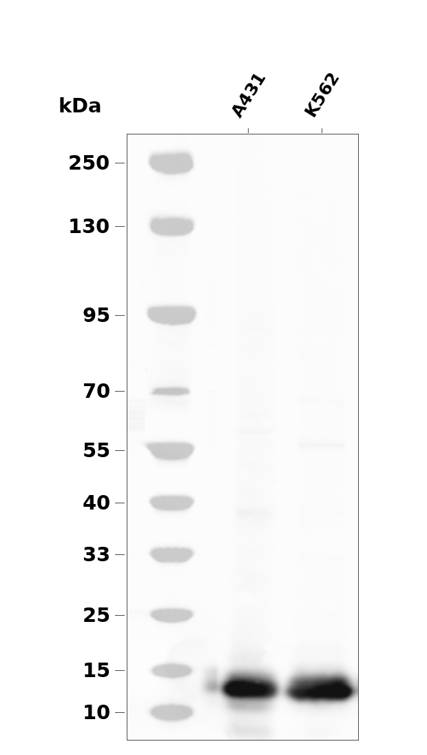 Phospho-4E-BP1 (Thr45) Rabbit pAb