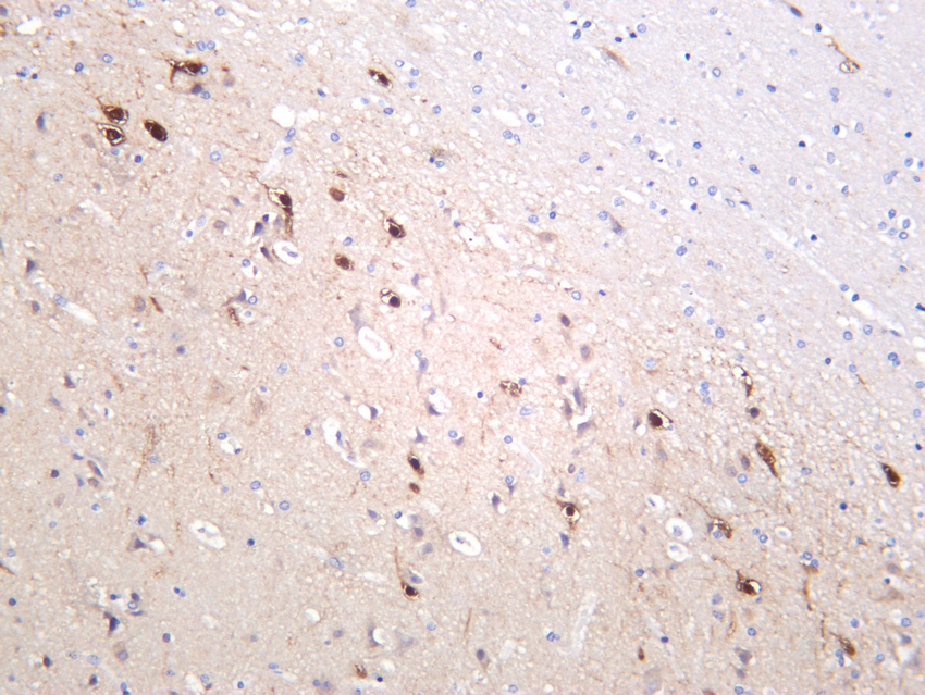 PSD95 Rabbit mAb