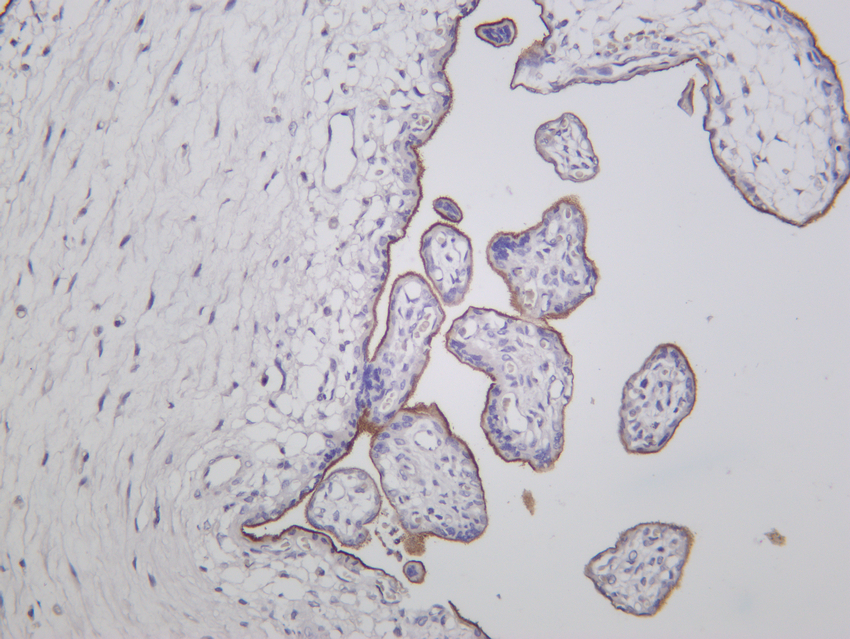 CD105 Rabbit mAb